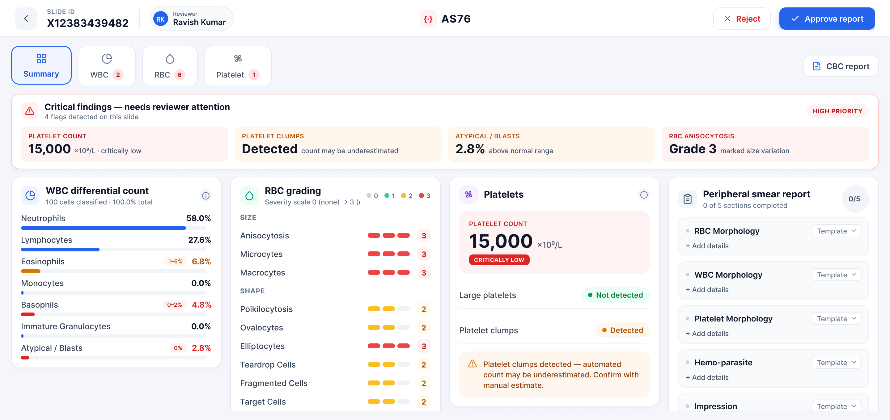 AS76 reviewer console