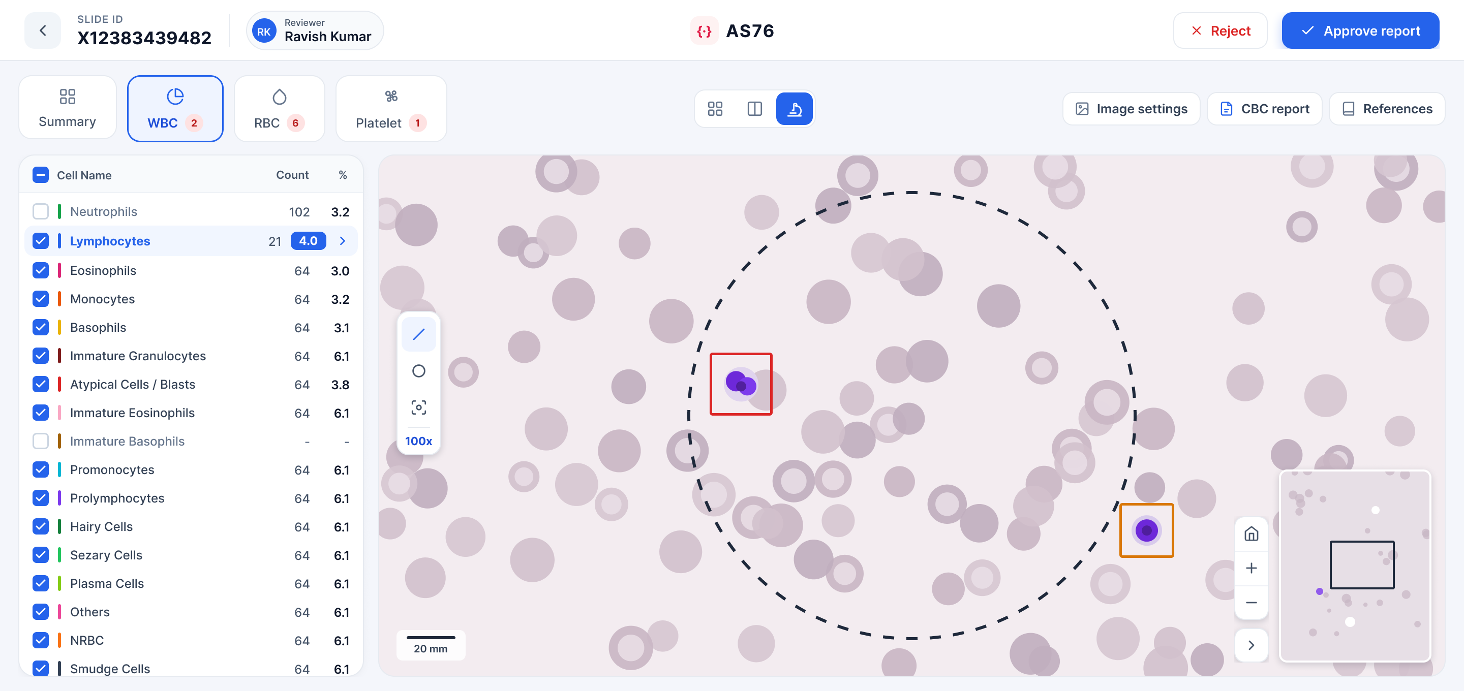 Whole-slide microscope view with measurement and annotation tools