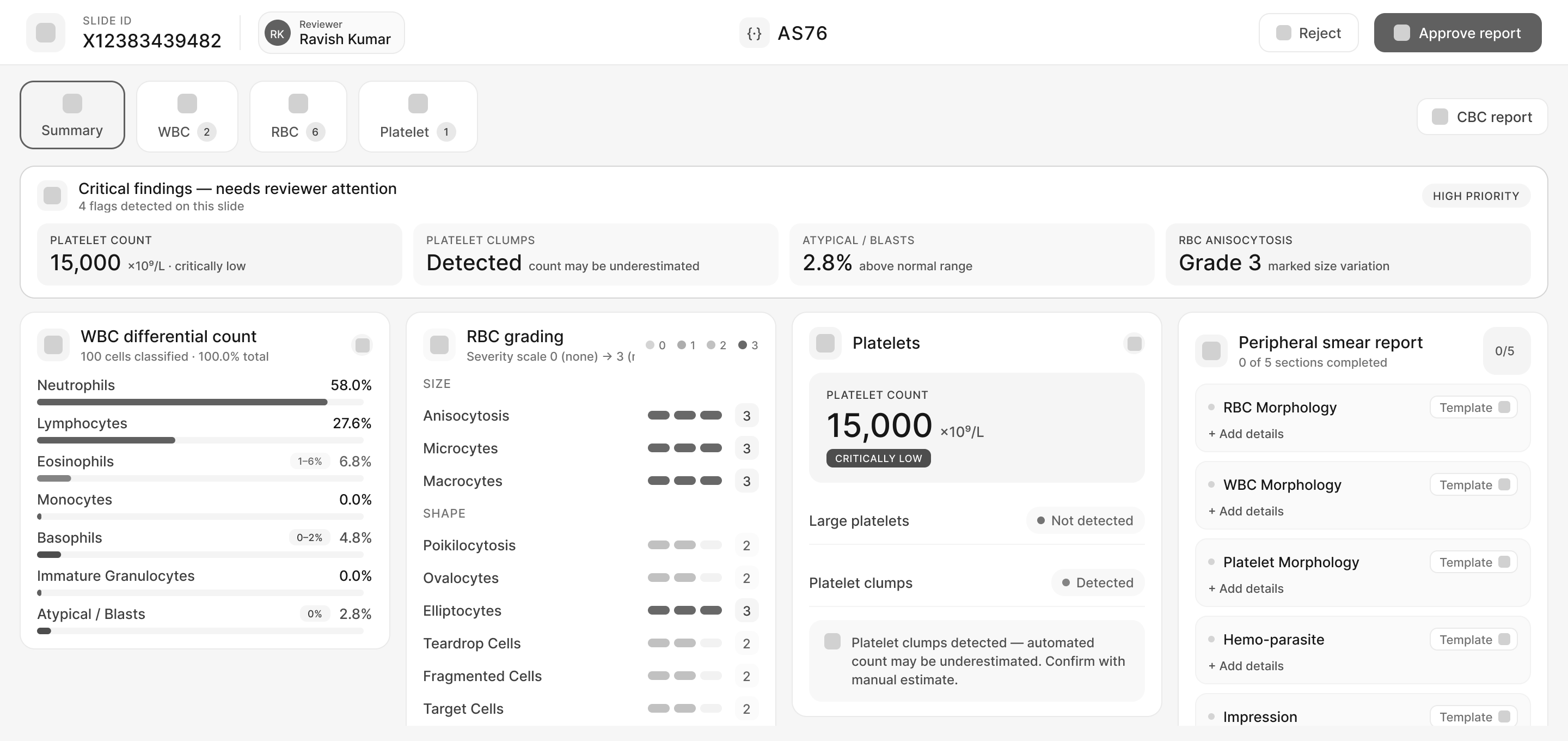 AS76 summary — wireframe