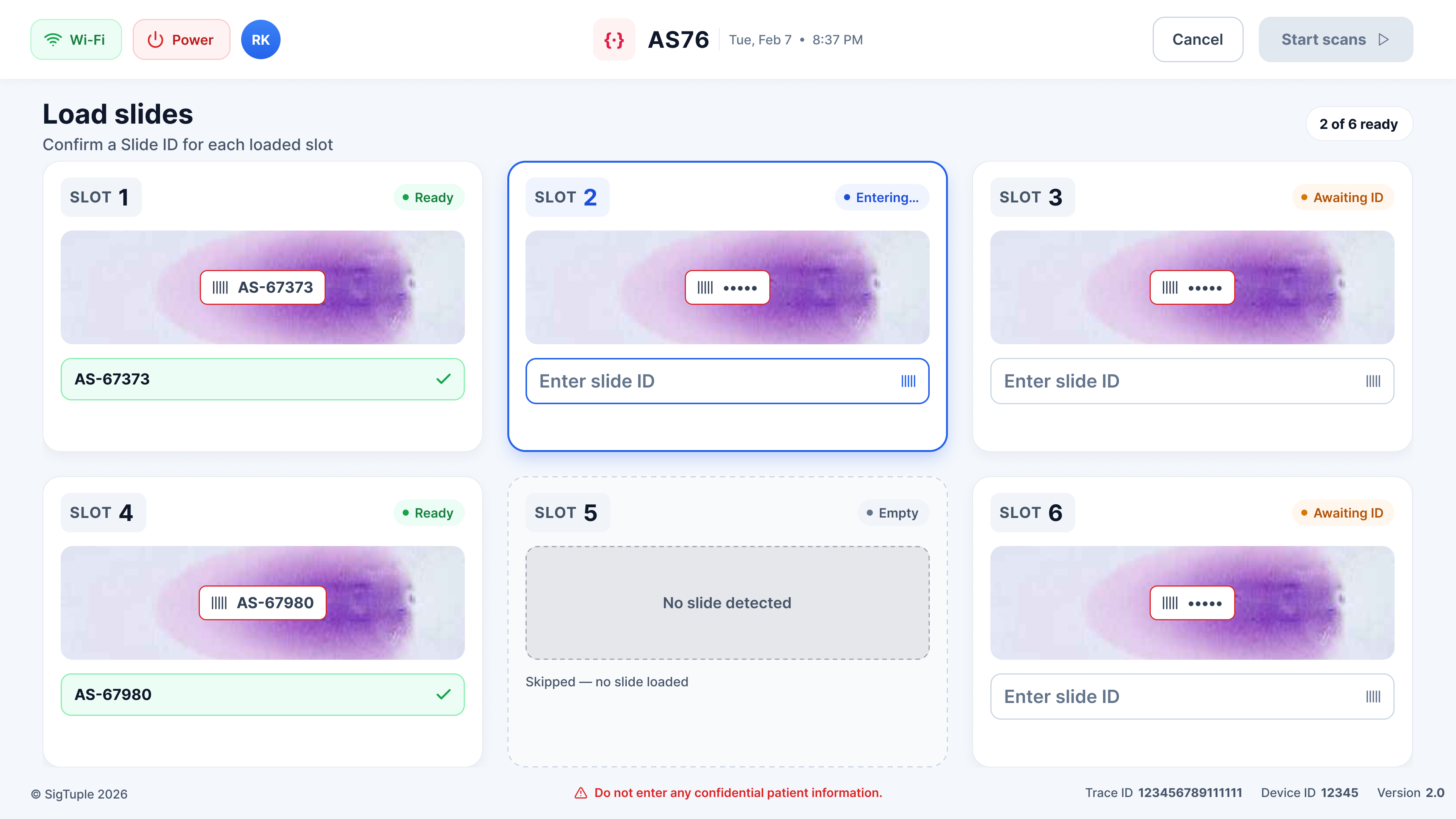 Load slides, six tray slots with barcode previews, slide ID inputs and Ready / Awaiting ID / Empty states
